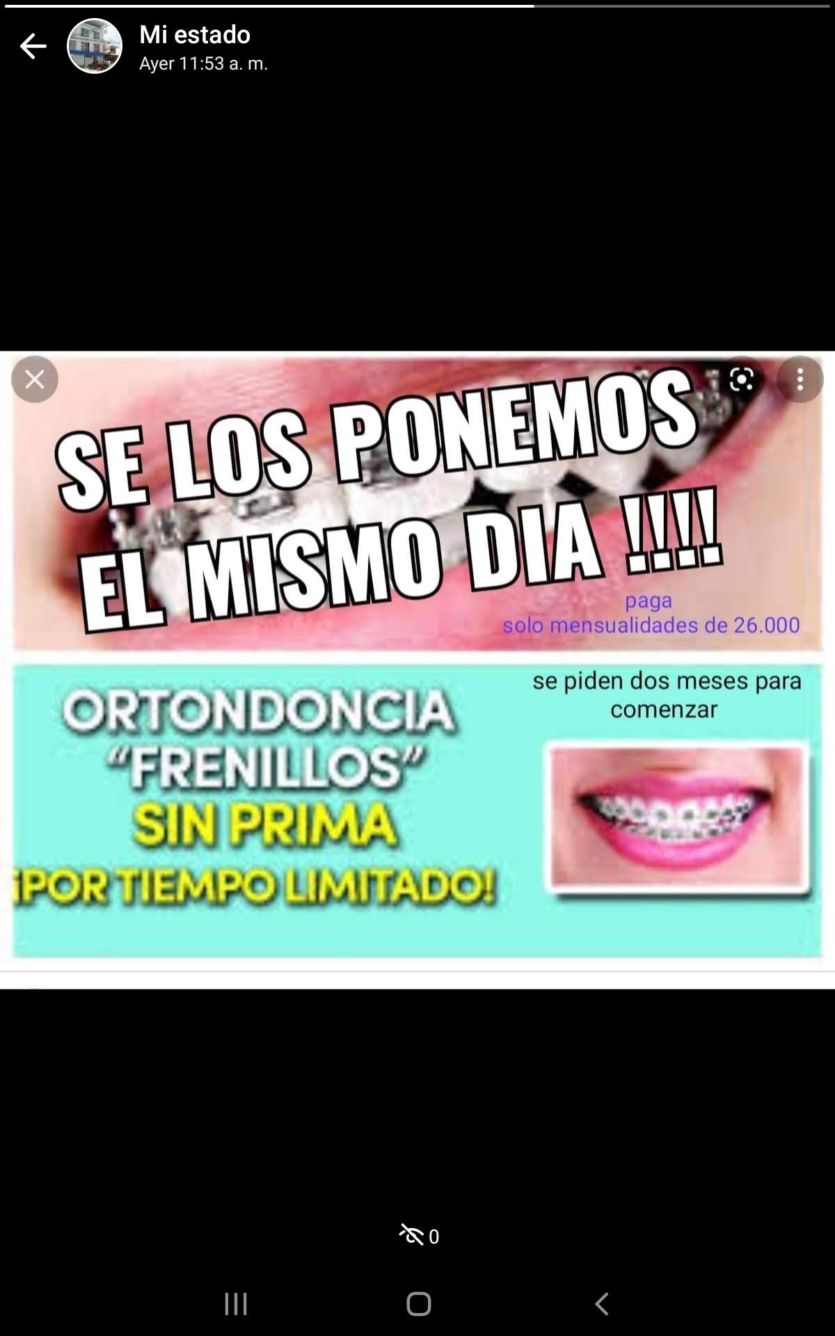 Dentista, frenillos sin prima , implantes dentales, emergencias dentales